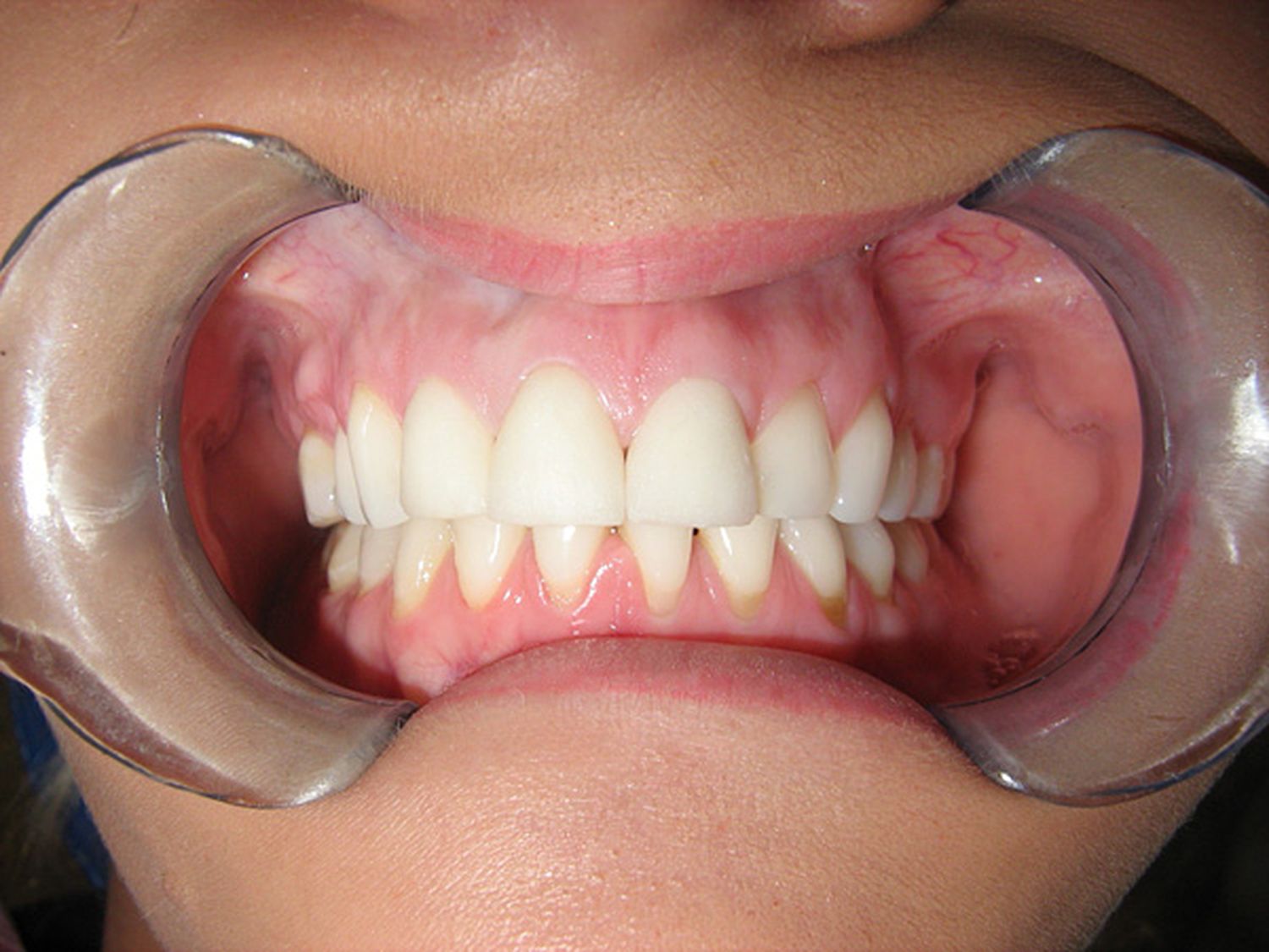 Zdravý úsměv začíná u správného zubaře